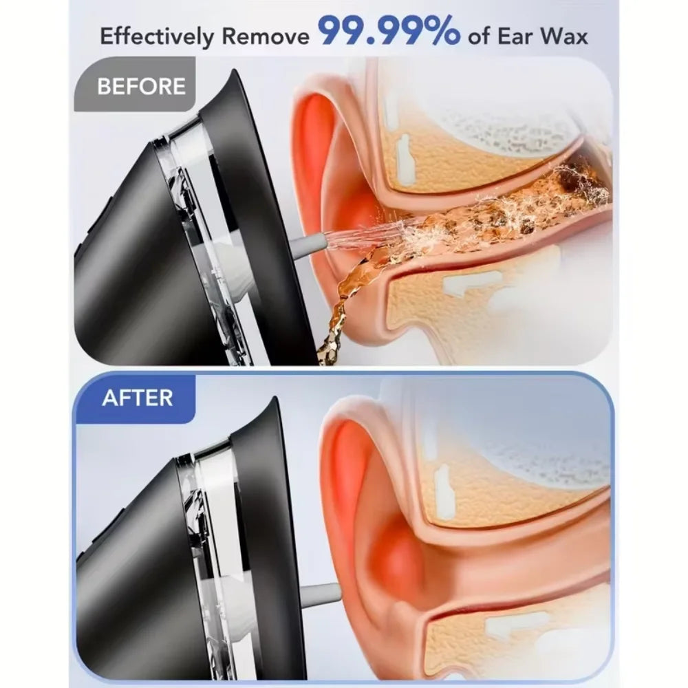 Electric Ear Irrigation Cleaner with Three Pressure Modes Rechargeable Battery Dual Water Tank and Multiple Nozzles for Home Use